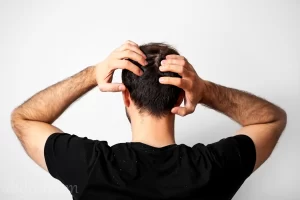 افضل شامبو للقشرة والحكة | 10 لعلاج قشرة الرأس والحكة